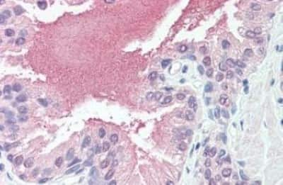 Immunohistochemistry-Paraffin: SLITRK6 Antibody [NBP3-14477] - SLITRK6 antibody IHC of human prostate. Immunohistochemistry of formalin-fixed, paraffin-embedded tissue after heat-induced antigen retrieval.